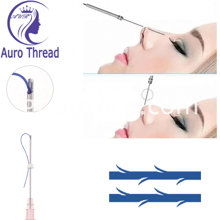 pdo thead ανελκυστήρα pdo thead lift